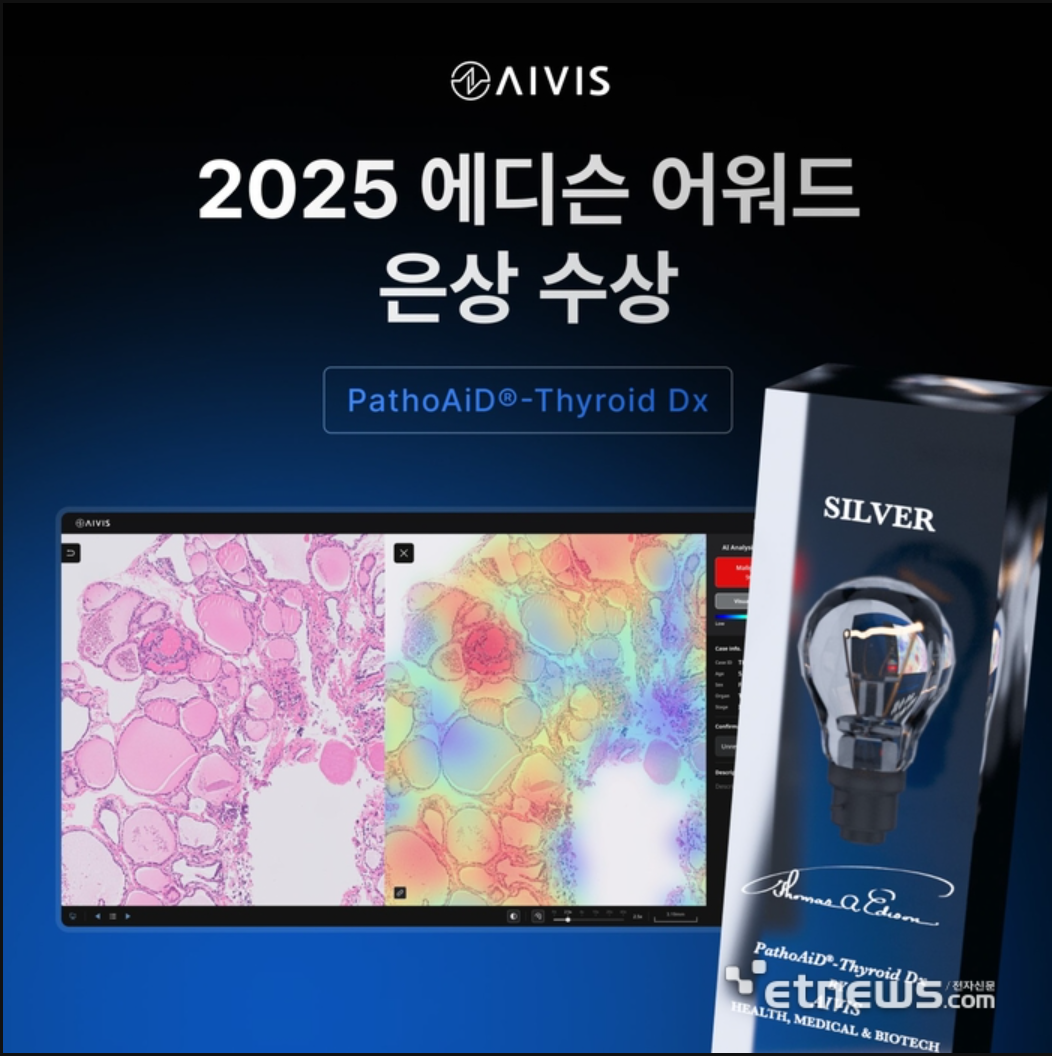 AIVIS Wins Silver at 2025 Edison Awards for AI-Powered Thyroid Cancer Diagnostic Solution