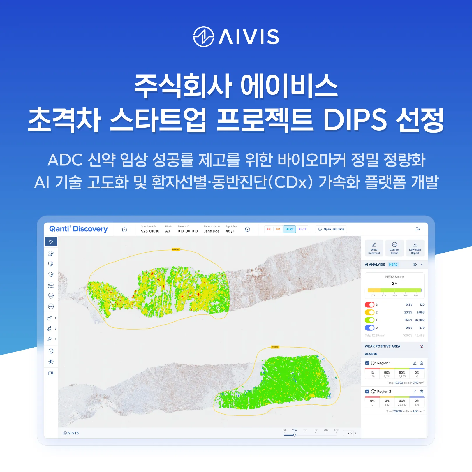 AIVIS Selected for Government’s "DIPS 1000+" Deep Tech Project to Advance ADC Biomarker Quantification