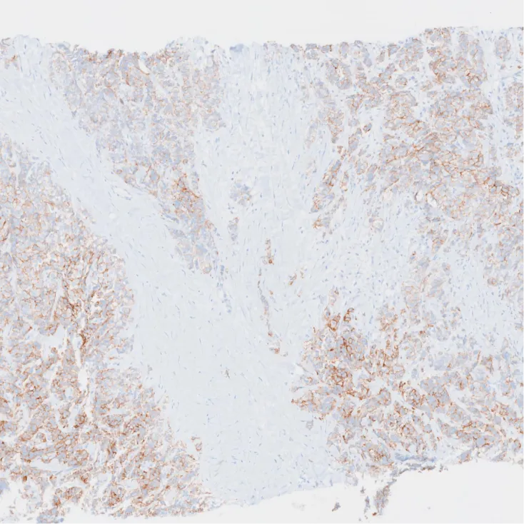 Overview workflow step 1