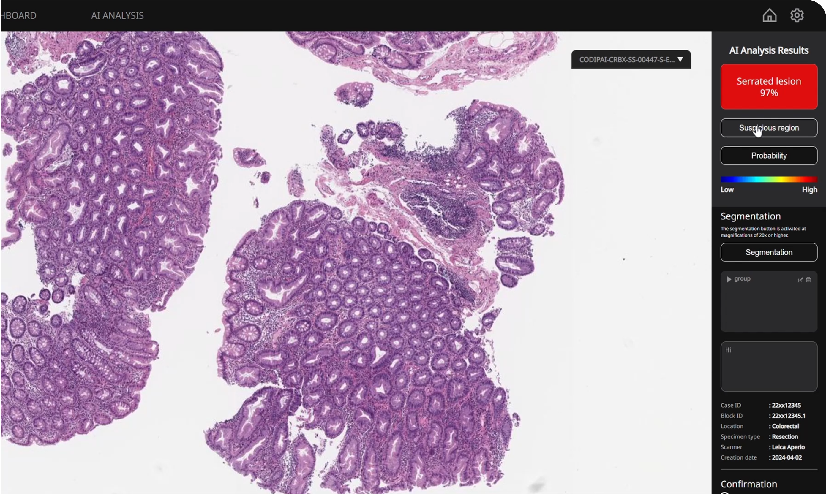 /images/pathoAiD-colon-dx/keyFeatures.png